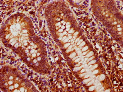 IHC image of CSB-PA05799A0Rb diluted at 1:600 and staining in paraffin-embedded human appendix tissue performed on a Leica BondTM system. After dewaxing and hydration, antigen retrieval was mediated by high pressure in a citrate buffer (pH 6.0). Section was blocked with 10% normal goat serum 30min at RT. Then primary antibody (1% BSA) was incubated at 4°C overnight. The primary is detected by a biotinylated secondary antibody and visualized using an HRP conjugated SP system.