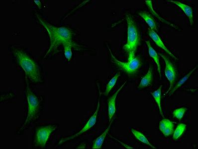 Immunofluorescence staining of Hela cells with CSB-PA06029A0Rb at 1:66, counter-stained with DAPI. The cells were fixed in 4% formaldehyde, permeabilized using 0.2% Triton X-100 and blocked in 10% normal Goat Serum. The cells were then incubated with the antibody overnight at 4°C. The secondary antibody was Alexa Fluor 488-congugated AffiniPure Goat Anti-Rabbit IgG(H+L).