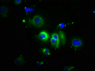 Immunofluorescence(IF) 2- CDH1 Antibody
