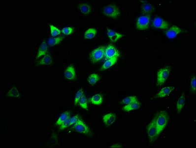 Immunofluorescence staining of HepG2 cells with CSB-PA07085A0Rb at 1:200, counter-stained with DAPI. The cells were fixed in 4% formaldehyde, permeabilized using 0.2% Triton X-100 and blocked in 10% normal Goat Serum. The cells were then incubated with the antibody overnight at 4°C. The secondary antibody was Alexa Fluor 488-congugated AffiniPure Goat Anti-Rabbit IgG(H+L). Immunofluorescence staining of HepG2 cells with CSB-PA07085A0Rb at 1:200, counter-stained with DAPI. The cells were fixed in 4% formaldehyde, permeabilized using 0.2% Triton X-100 and blocked in 10% normal Goat Serum. The cells were then incubated with the antibody overnight at 4°C. The secondary antibody was Alexa Fluor 488-congugated AffiniPure Goat Anti-Rabbit IgG(H+L).