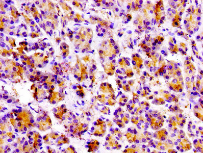IHC image of CSB-PA12319A0Rb diluted at 1:100 and staining in paraffin-embedded human pancreatic tissue performed on a Leica BondTM system. After dewaxing and hydration, antigen retrieval was mediated by high pressure in a citrate buffer (pH 6.0). Section was blocked with 10% normal goat serum 30min at RT. Then primary antibody (1% BSA) was incubated at 4°C overnight. The primary is detected by a biotinylated secondary antibody and visualized using an HRP conjugated SP system.