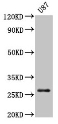 Western Blot Positive WB detected in: U87 whole cell lysate All lanes: PRSS3 antibody at 3microg/ml Secondary Goat polyclonal to rabbit IgG at 1/50000 dilution Predicted band size: 33, 29, 27, 26 kDa Observed band size: 27 kDa