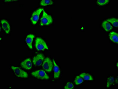Immunofluorescence staining of A549 cells with CSB-PA13269A0Rb at 1:100, counter-stained with DAPI. The cells were fixed in 4% formaldehyde, permeabilized using 0.2% Triton X-100 and blocked in 10% normal Goat Serum. The cells were then incubated with the antibody overnight at 4°C. The secondary antibody was Alexa Fluor 488-congugated AffiniPure Goat Anti-Rabbit IgG(H+L).