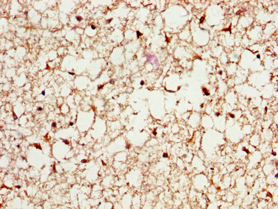 IHC image of CSB-PA13674A0Rb diluted at 1:200 and staining in paraffin-embedded human brain tissue performed on a Leica BondTM system. After dewaxing and hydration, antigen retrieval was mediated by high pressure in a citrate buffer (pH 6.0). Section was blocked with 10% normal goat serum 30min at RT. Then primary antibody (1% BSA) was incubated at 4°C overnight. The primary is detected by a biotinylated secondary antibody and visualized using an HRP conjugated SP system.
