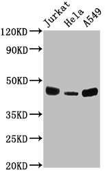 Western Blot Positive WB detected in: Jurkat whole cell lysate, Hela whole cell lysate, A549 whole cell lysate All lanes: HLA-C antibody at 1:2000 Secondary Goat polyclonal to rabbit IgG at 1/50000 dilution Predicted band size: 41 kDa Observed band size: 41 kDa