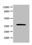 Western Blotting(WB) 2- MAPK8 Antibody