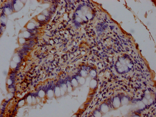 IHC image of CSB-PA17772A0Rb diluted at 1:140 and staining in paraffin-embedded human small intestine tissue performed on a Leica BondTM system. After dewaxing and hydration, antigen retrieval was mediated by high pressure in a citrate buffer (pH 6.0). Section was blocked with 10% normal goat serum 30min at RT. Then primary antibody (1% BSA) was incubated at 4°C overnight. The primary is detected by a Goat anti-rabbit IgG labeled by HRP and visualized using 0.05% DAB. IHC image of CSB-PA17772A0Rb diluted at 1:140 and staining in paraffin-embedded human small intestine tissue performed on a Leica BondTM system. After dewaxing and hydration, antigen retrieval was mediated by high pressure in a citrate buffer (pH 6.0). Section was blocked with 10% normal goat serum 30min at RT. Then primary antibody (1% BSA) was incubated at 4°C overnight. The primary is detected by a Goat anti-rabbit IgG labeled by HRP and visualized using 0.05% DAB.