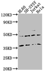 Western Blot Positive WB detected in: HL60 whole cell lysate, SH-SY5Y whole cell lysate, Jurkat whole cell lysate, Hela whole cell lysate All lanes: CASTOR2 antibody at 1:2000 Secondary Goat polyclonal to rabbit IgG at 1/50000 dilution Predicted band size: 37 kDa Observed band size: 37 kDa