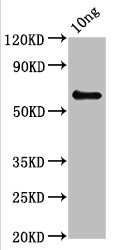 Western Blotting(WB) - pepP Antibody