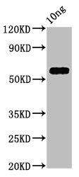 Western Blotting(WB) - PRA1 Antibody