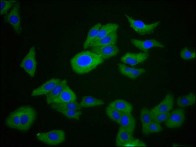 Immunofluorescence staining of HepG2 cells with CSB-PA618785LA01HU at 1:266, counter-stained with DAPI. The cells were fixed in 4% formaldehyde, permeabilized using 0.2% Triton X-100 and blocked in 10% normal Goat Serum. The cells were then incubated with the antibody overnight at 4°C. The secondary antibody was Alexa Fluor 488-congugated AffiniPure Goat Anti-Rabbit IgG(H+L).