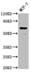 Western Blot Positive WB detected in: MCF-7 whole cell lysate All lanes: RPE65 antibody at 1:2000 Secondary Goat polyclonal to rabbit IgG at 1/50000 dilution Predicted band size: 61 kDa Observed band size: 61 kDa