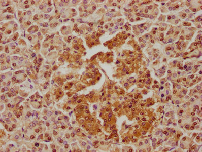IHC image of CSB-PA637287LA01HU diluted at 1:100 and staining in paraffin-embedded human pancreatic tissue performed on a Leica BondTM system. After dewaxing and hydration, antigen retrieval was mediated by high pressure in a citrate buffer (pH 6.0). Section was blocked with 10% normal goat serum 30min at RT. Then primary antibody (1% BSA) was incubated at 4°C overnight. The primary is detected by a biotinylated secondary antibody and visualized using an HRP conjugated SP system.
