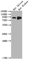 Western Blot Positive WB detected in: Rat Spleen tissue, Rat Kidney tissue All lanes: Ace2 antibody at 1:2000 Secondary Goat polyclonal to rabbit IgG at 1/50000 dilution Predicted band size: 93 kDa Observed band size: 93 kDa