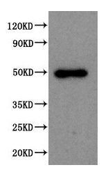 Western Blot Positive WB detected in: 293T whole cell lysate All lanes: SPOCK1 antibody at 1:2000 Secondary Goat polyclonal to rabbit IgG at 1/50000 dilution Predicted band size: 50 kDa Observed band size: 50 kDa Western Blot Positive WB detected in: 293T whole cell lysate All lanes: SPOCK1 antibody at 1:2000 Secondary Goat polyclonal to rabbit IgG at 1/50000 dilution Predicted band size: 50 kDa Observed band size: 50 kDa