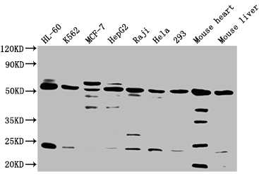 Western Blot Positive WB detected in: HL60 whole cell lysate, K562 whole cell lysate, MCF-7 whole cell lysate, HepG2 whole cell lysate, Raji whole cell lysate, Hela whole cell lysate, 293 whole cell lysate, Mouse heart tissue, Mouse liver tissue All lanes: NCR3LG1 antibody at 1:2000 Secondary Goat polyclonal to rabbit IgG at 1/50000 dilution Predicted band size: 51 kDa Observed band size: 51 kDa