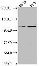 Western Blot Positive WB detected in: Hela whole cell lysate, PC3 whole cell lysate All lanes: PKN3 antibody at 1:2000 Secondary Goat polyclonal to rabbit IgG at 1/50000 dilution Predicted band size: 100 kDa Observed band size: 100 kDa