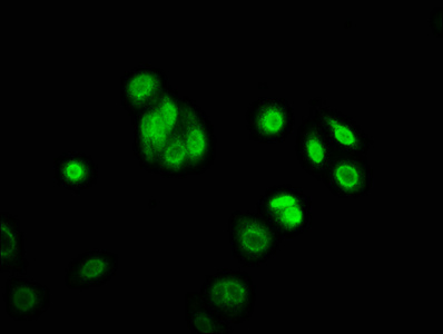 Immunofluorescence staining of HepG2 cells with CSB-PA755509LA01HU at 1:166, counter-stained with DAPI. The cells were fixed in 4% formaldehyde, permeabilized using 0.2% Triton X-100 and blocked in 10% normal Goat Serum. The cells were then incubated with the antibody overnight at 4°C. The secondary antibody was Alexa Fluor 488-congugated AffiniPure Goat Anti-Rabbit IgG(H+L).
