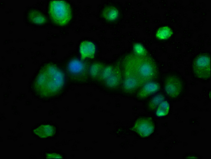 Immunofluorescence staining of MCF-7 cells with CSB-PA761499LA01HU at 1:133, counter-stained with DAPI. The cells were fixed in 4% formaldehyde, permeabilized using 0.2% Triton X-100 and blocked in 10% normal Goat Serum. The cells were then incubated with the antibody overnight at 4°C. The secondary antibody was Alexa Fluor 488-congugated AffiniPure Goat Anti-Rabbit IgG(H+L).
