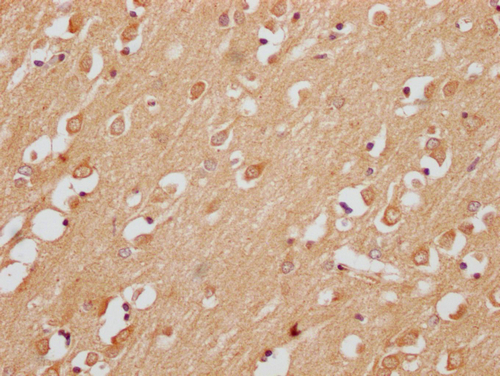 IHC image of CSB-PA774793LA01HU diluted at 1:200 and staining in paraffin-embedded human brain tissue performed on a Leica BondTM system. After dewaxing and hydration, antigen retrieval was mediated by high pressure in a citrate buffer (pH 6.0). Section was blocked with 10% normal goat serum 30min at RT. Then primary antibody (1% BSA) was incubated at 4°C overnight. The primary is detected by a Goat anti-rabbit polymer IgG labeled by HRP and visualized using 0.05% DAB.