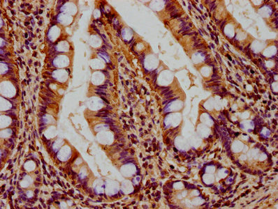 CSB-PA810289LA01HU