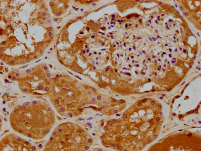 IHC image of CSB-PA810289LA01HU diluted at 1:400 and staining in paraffin-embedded human kidney tissue performed on a Leica BondTM system. After dewaxing and hydration, antigen retrieval was mediated by high pressure in a citrate buffer (pH 6.0). Section was blocked with 10% normal goat serum 30min at RT. Then primary antibody (1% BSA) was incubated at 4°C overnight. The primary is detected by a biotinylated secondary antibody and visualized using an HRP conjugated SP system.