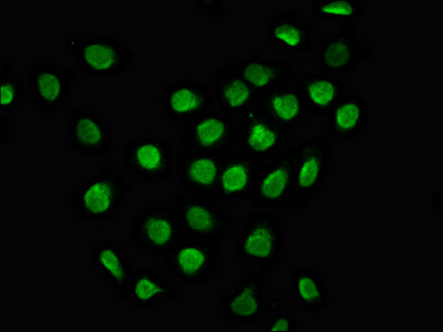 Immunofluorescence staining of A549 cells with CSB-PA815545LA01HU at 1:100, counter-stained with DAPI. The cells were fixed in 4% formaldehyde, permeabilized using 0.2% Triton X-100 and blocked in 10% normal Goat Serum. The cells were then incubated with the antibody overnight at 4°C. The secondary antibody was Alexa Fluor 488-congugated AffiniPure Goat Anti-Rabbit IgG(H+L).