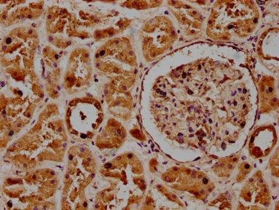 IHC image of CSB-PA818754LA01HU diluted at 1:300 and staining in paraffin-embedded human kidney tissue performed on a Leica BondTM system. After dewaxing and hydration, antigen retrieval was mediated by high pressure in a citrate buffer (pH 6.0). Section was blocked with 10% normal goat serum 30min at RT. Then primary antibody (1% BSA) was incubated at 4°C overnight. The primary is detected by a biotinylated secondary antibody and visualized using an HRP conjugated SP system.