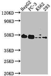 Western Blot Positive WB detected in: HepG2 whole cell lysate, PC-3 whole cell lysate, K562 whole cell lysate, 293 whole cell lysate All lanes: POGLUT1 antibody at 1:2000 Secondary Goat polyclonal to rabbit IgG at 1/50000 dilution Predicted band size: 47 kDa Observed band size: 47 kDa