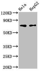 Western Blot Positive WB detected in: Hela whole cell lysate, HepG2 whole cell lysate All lanes: FRMD6 antibody at 3microg/ml Secondary Goat polyclonal to rabbit IgG at 1/50000 dilution Predicted band size: 73, 71, 30 kDa Observed band size: 73 kDa