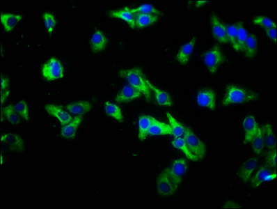 Immunofluorescence staining of HepG2 cells with CSB-PA822717LA01HU at 1:333, counter-stained with DAPI. The cells were fixed in 4% formaldehyde, permeabilized using 0.2% Triton X-100 and blocked in 10% normal Goat Serum. The cells were then incubated with the antibody overnight at 4°C. The secondary antibody was Alexa Fluor 488-congugated AffiniPure Goat Anti-Rabbit IgG(H+L).