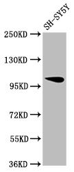 Western Blot Positive WB detected in: SH-SY5Y whole cell lysate All lanes: VPS39 antibody at 1:2000 Secondary Goat polyclonal to rabbit IgG at 1/50000 dilution Predicted band size: 102, 101 kDa Observed band size: 102 kDa