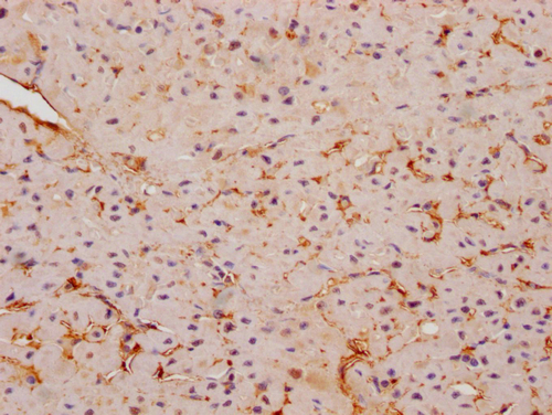 CSB-PA836707OA01HU