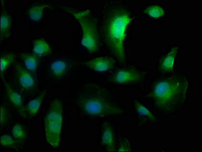 Immunofluorescence staining of U251 cells with CSB-PA843298LA01HU at 1:133, counter-stained with DAPI. The cells were fixed in 4% formaldehyde, permeabilized using 0.2% Triton X-100 and blocked in 10% normal Goat Serum. The cells were then incubated with the antibody overnight at 4°C. The secondary antibody was Alexa Fluor 488-congugated AffiniPure Goat Anti-Rabbit IgG(H+L).