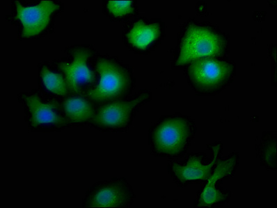 Immunofluorescence staining of A549 cells with CSB-PA847211LA01HU at 1:50, counter-stained with DAPI. The cells were fixed in 4% formaldehyde, permeabilized using 0.2% Triton X-100 and blocked in 10% normal Goat Serum. The cells were then incubated with the antibody overnight at 4°C. The secondary antibody was Alexa Fluor 488-congugated AffiniPure Goat Anti-Rabbit IgG(H+L).