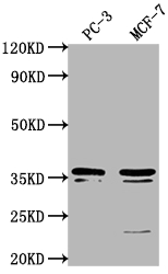 Western Blot Positive WB detected in: PC-3 whole cell lysate, MCF-7 whole cell lysate All lanes: OR6C1 antibody at 1:1000 Secondary Goat polyclonal to rabbit IgG at 1/50000 dilution Predicted band size: 36 kDa Observed band size: 36 kDa