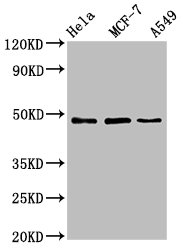 Western Blot Positive WB detected in: Hela whole cell lysate, MCF-7 whole cell lysate, A549 whole cell lysate All lanes: LCOR antibody at 4.6ug/ml Secondary Goat polyclonal to rabbit IgG at 1/50000 dilution Predicted band size: 48, 45, 107 kDa Observed band size: 48 kDa