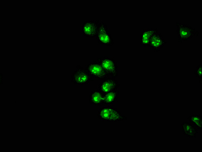 Immunofluorescence staining of Hela cells with CSB-PA859113EA01HU at 1:166, counter-stained with DAPI. The cells were fixed in 4% formaldehyde, permeabilized using 0.2% Triton X-100 and blocked in 10% normal Goat Serum. The cells were then incubated with the antibody overnight at 4°C. The secondary antibody was Alexa Fluor 488-congugated AffiniPure Goat Anti-Rabbit IgG(H+L).