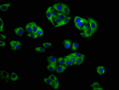Immunofluorescence staining of HepG2 cells with CSB-PA872494LA01HU at 1:133, counter-stained with DAPI. The cells were fixed in 4% formaldehyde, permeabilized using 0.2% Triton X-100 and blocked in 10% normal Goat Serum. The cells were then incubated with the antibody overnight at 4°C. The secondary antibody was Alexa Fluor 488-congugated AffiniPure Goat Anti-Rabbit IgG(H+L).