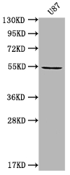 Western Blot Positive WB detected in: U87 whole cell lysate All lanes: MROH8 antibody at 1:2000 Secondary Goat polyclonal to rabbit IgG at 1/50000 dilution Predicted band size: 55, 100 kDa Observed band size: 55 kDa