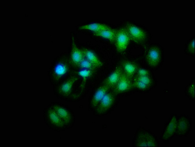Immunofluorescence staining of HepG2 cells with CSB-PA872519HA01HU at 1:333, counter-stained with DAPI. The cells were fixed in 4% formaldehyde, permeabilized using 0.2% Triton X-100 and blocked in 10% normal Goat Serum. The cells were then incubated with the antibody overnight at 4°C. The secondary antibody was Alexa Fluor 488-congugated AffiniPure Goat Anti-Rabbit IgG(H+L).