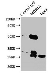 Immunoprecipitating MOB1A in Jurkat whole cell lysate Lane 1: Rabbit control IgG instead of CSB-PA872519HA01HU in Jurkat whole cell lysate. For western blotting, a HRP-conjugated Protein G antibody was used as the secondary antibody (1/2000) Lane 2: CSB-PA872519HA01HU (5microg) + Jurkat whole cell lysate (500microg) Lane 3: Jurkat whole cell lysate (20microg)