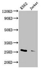 Western Blot Positive WB detected in: K562 whole cell lysate, Jurkat whole cell lysate All lanes: MOB1A antibody at 3.3microg/ml Secondary Goat polyclonal to rabbit IgG at 1/50000 dilution Predicted band size: 26, 17 kDa Observed band size: 26 kDa