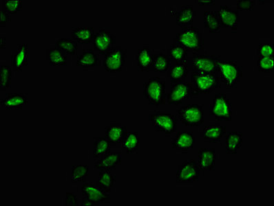 Immunofluorescence staining of Hela cells with CSB-PA874842LA01HU at 1:66, counter-stained with DAPI. The cells were fixed in 4% formaldehyde, permeabilized using 0.2% Triton X-100 and blocked in 10% normal Goat Serum. The cells were then incubated with the antibody overnight at 4°C. The secondary antibody was Alexa Fluor 488-congugated AffiniPure Goat Anti-Rabbit IgG(H+L).