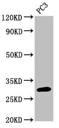 Western Blot Positive WB detected in: PC-3 whole cell lysate All lanes: MRO antibody at 3microg/ml Secondary Goat polyclonal to rabbit IgG at 1/50000 dilution Predicted band size: 30, 25, 31, 24 kDa Observed band size: 30 kDa
