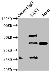 Immunoprecipitating SAV1 in NIH/3T3 whole cell lysate Lane 1: Rabbit control IgG instead of CSB-PA875672ESR2HU in NIH/3T3 whole cell lysate. For western blotting, a HRP-conjugated Protein G antibody was used as the secondary antibody (1/2000) Lane 2: CSB-PA875672ESR2HU (5microg) + NIH/3T3 whole cell lysate (500microg) Lane 3: NIH/3T3 whole cell lysate (20microg)