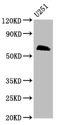 Western Blot Positive WB detected in: U251 whole cell lysate All lanes: MSL2 antibody at 5microg/ml Secondary Goat polyclonal to rabbit IgG at 1/50000 dilution Predicted band size: 63, 55 kDa Observed band size: 63 kDa