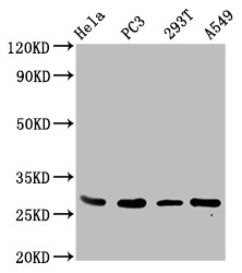 Western Blot Positive WB detected in: Hela whole cell lysate, PC-3 whole cell lysate, 293T whole cell lysate, A549 whole cell lysate All lanes: EFHD1 antibody at 3.4ug/ml Secondary Goat polyclonal to rabbit IgG at 1/50000 dilution Predicted band size: 27, 17 kDa Observed band size: 27 kDa