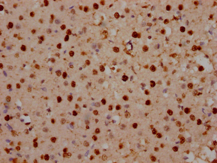 IHC image of CSB-PA892170LA01HU diluted at 1:100 and staining in paraffin-embedded human brain tissue performed on a Leica BondTM system. After dewaxing and hydration, antigen retrieval was mediated by high pressure in a citrate buffer (pH 6.0). Section was blocked with 10% normal goat serum 30min at RT. Then primary antibody (1% BSA) was incubated at 4°C overnight. The primary is detected by a Goat anti-rabbit IgG labeled by HRP and visualized using 0.05% DAB.