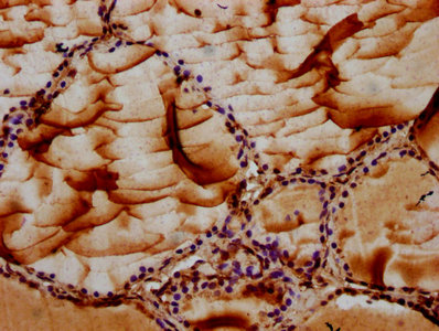 IHC image of CSB-PA896489LA01HU diluted at 1:100 and staining in paraffin-embedded human thyroid tissue performed on a Leica BondTM system. After dewaxing and hydration, antigen retrieval was mediated by high pressure in a citrate buffer (pH 6.0). Section was blocked with 10% normal goat serum 30min at RT. Then primary antibody (1% BSA) was incubated at 4°C overnight. The primary is detected by a biotinylated secondary antibody and visualized using an HRP conjugated SP system.